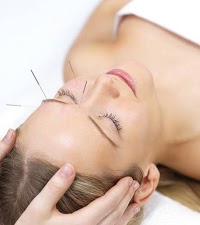 Acupuncture UK affordable 721849 Image 3